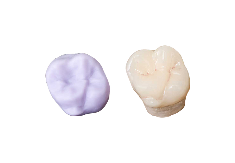 Dental Emax Milling Machine - Glorious Dental Materials Co. Ltd.