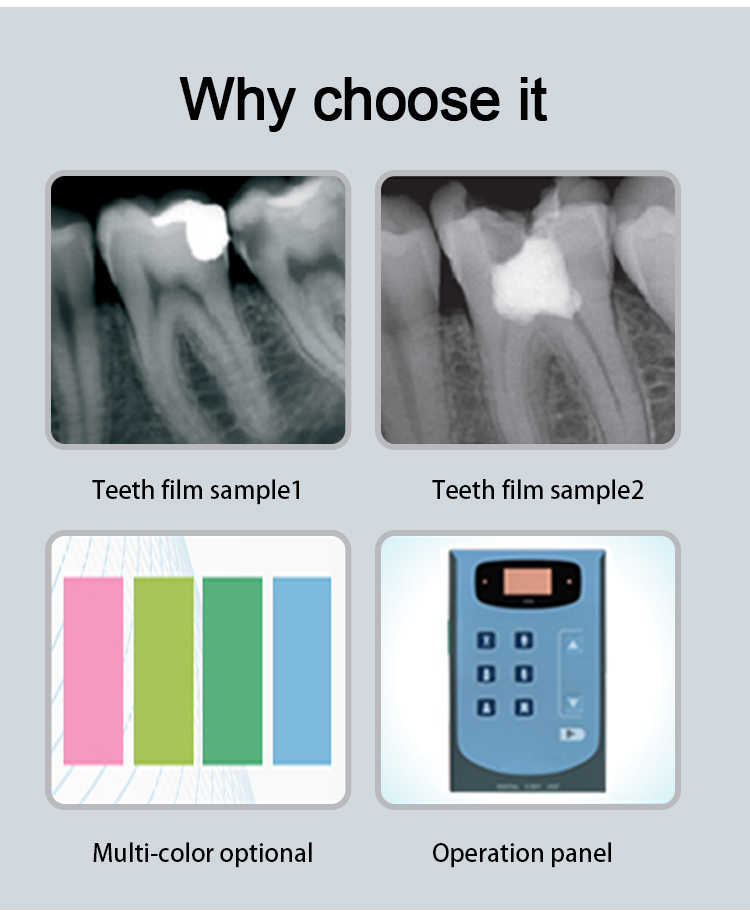 Cost Of Dental X Ray Machine Supplier_For Sale_Price Glorious Dental